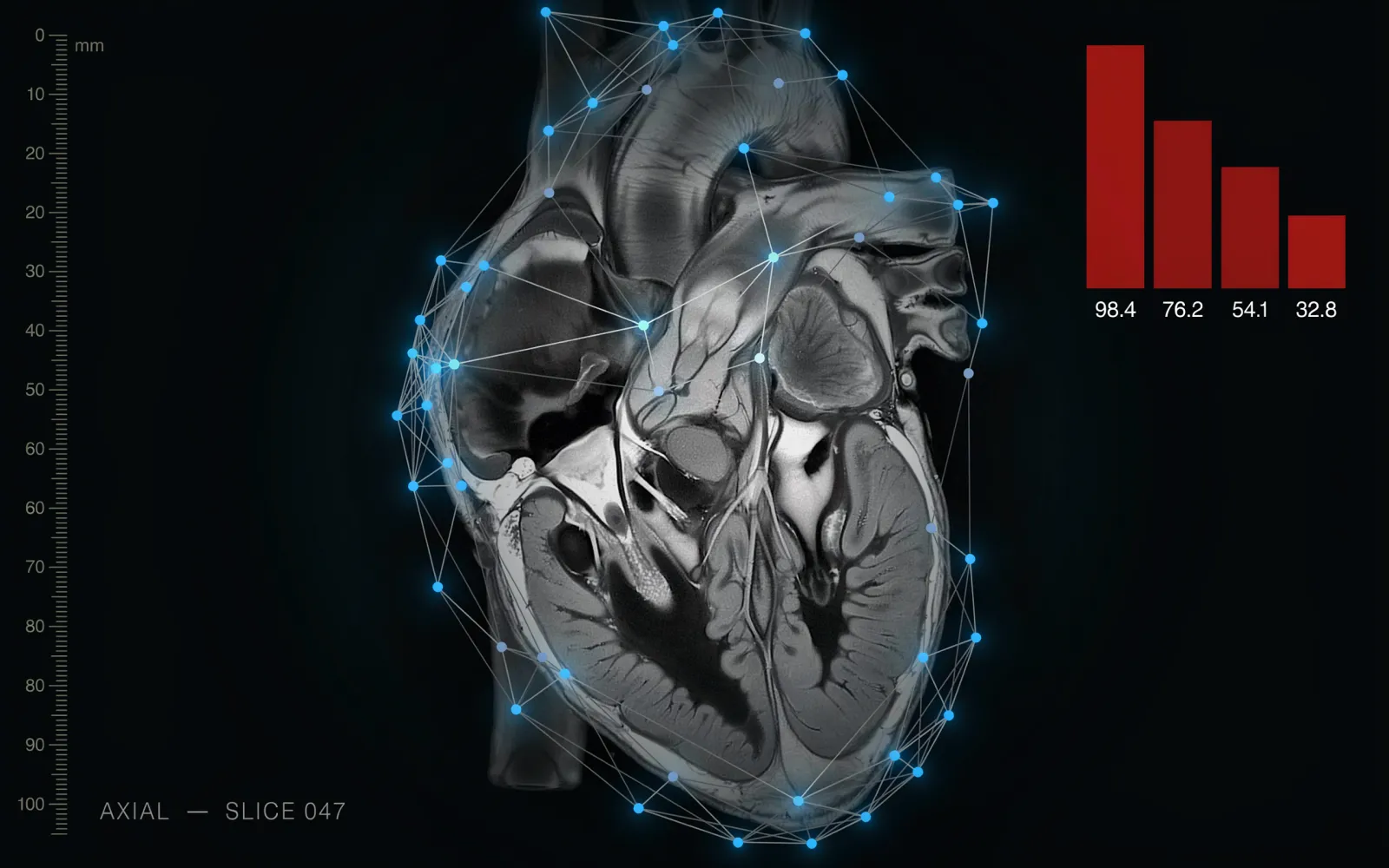 CMR-CLIP AI Model Achieves High Accuracy in Cardiac MRI Diagnosis, Outperforms Existing Tools